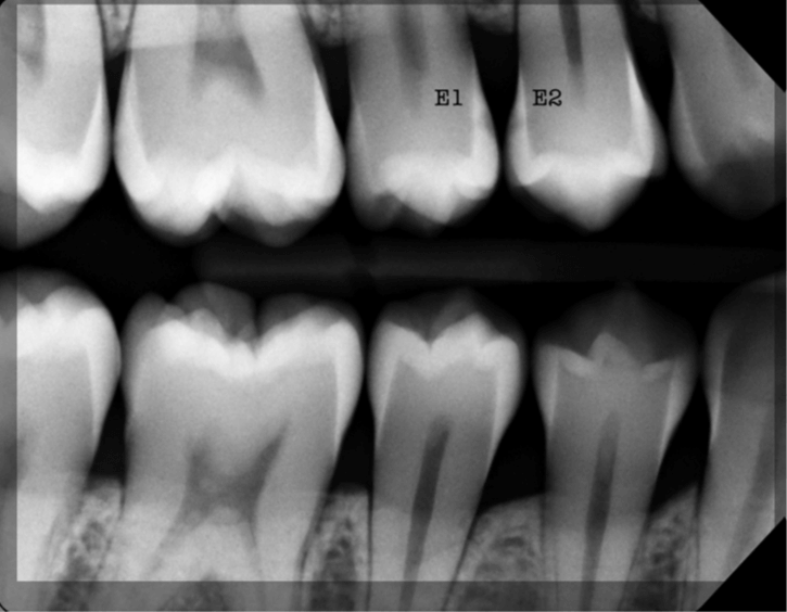 Científicos rusos desarrollan dispositivo que detecta caries en tiempo real cientificos-rusos-desarrollan-dispositivo-que-detecta-caries-en-tiempo-real