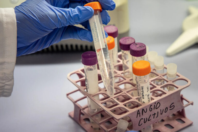 speranza para millones: terapia génica busca detener el desarrollo del alzhéimer