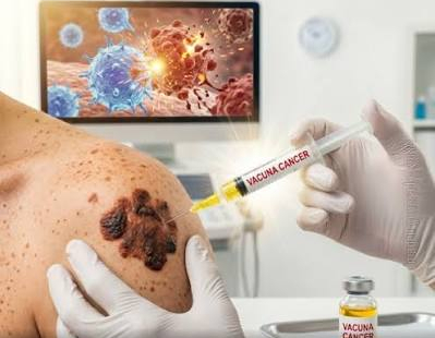 1ª vacuna contra cáncer de piel supera con éxito última fase de ensayo
